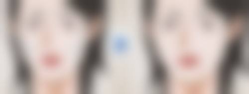 四、肿眼泡双眼皮修复的注意事项