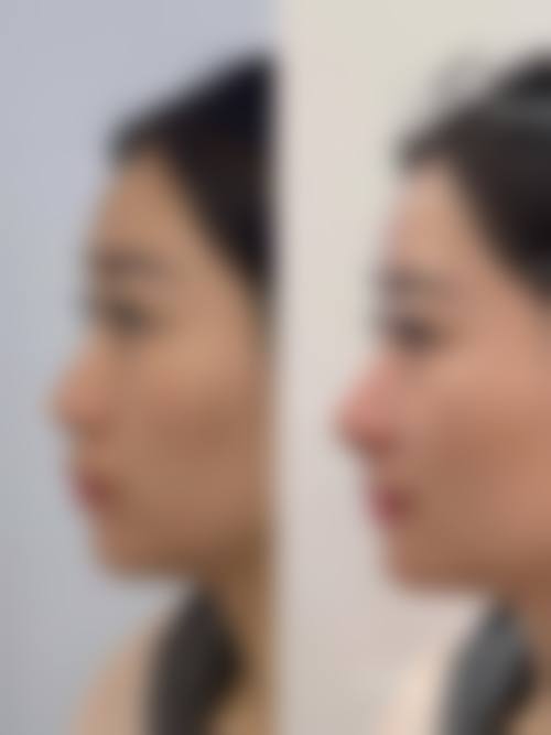 二、东莞百佳医疗整形医院怎么样？