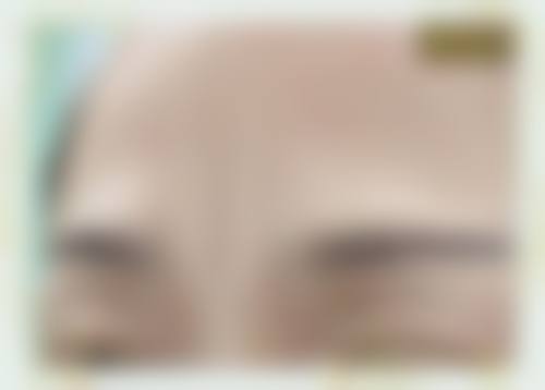 四、韩国cellpark皮肤科特色项目