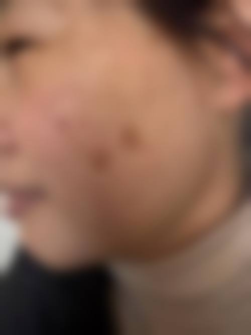 三、杭州和瑞医疗美容门诊部诊疗项目有哪些？