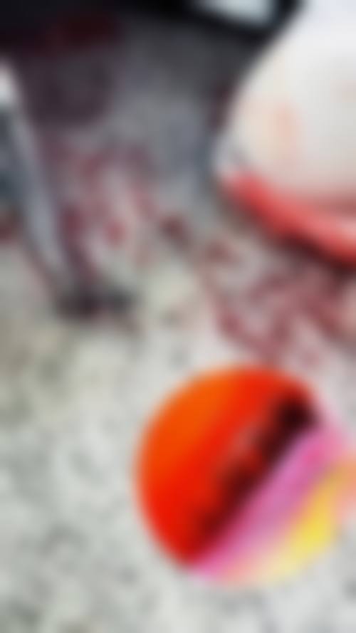 四、广州碧莲盛植发医院特色项目