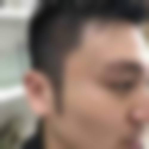 二、广州碧莲盛植发医院怎么样？