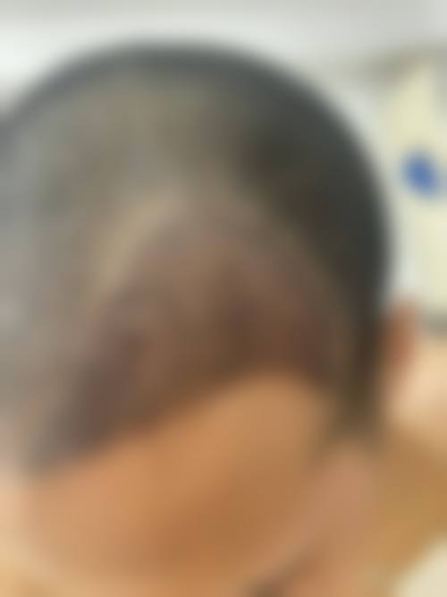 七、广州碧莲盛植发医院地址及交通