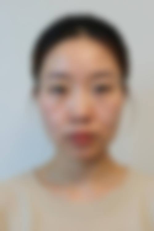 四、汕头中山大学附属汕头医院医学整形激光美容医院特色项目