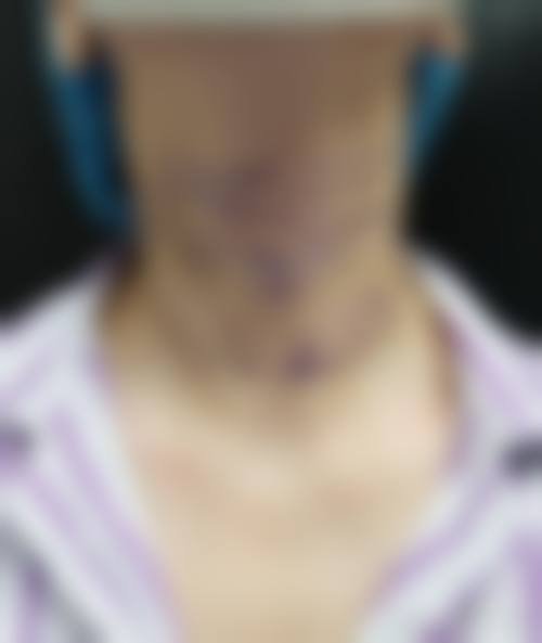 九、东莞百佳医疗整形医院真实的患者评价