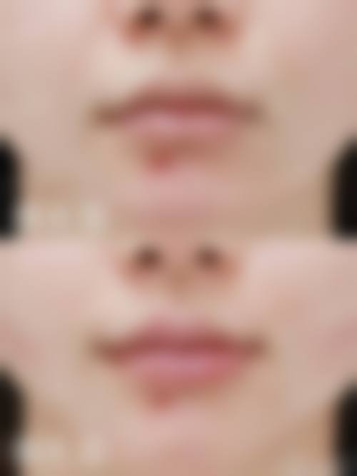 五、咸宁新绣格医疗美容诊所价格表