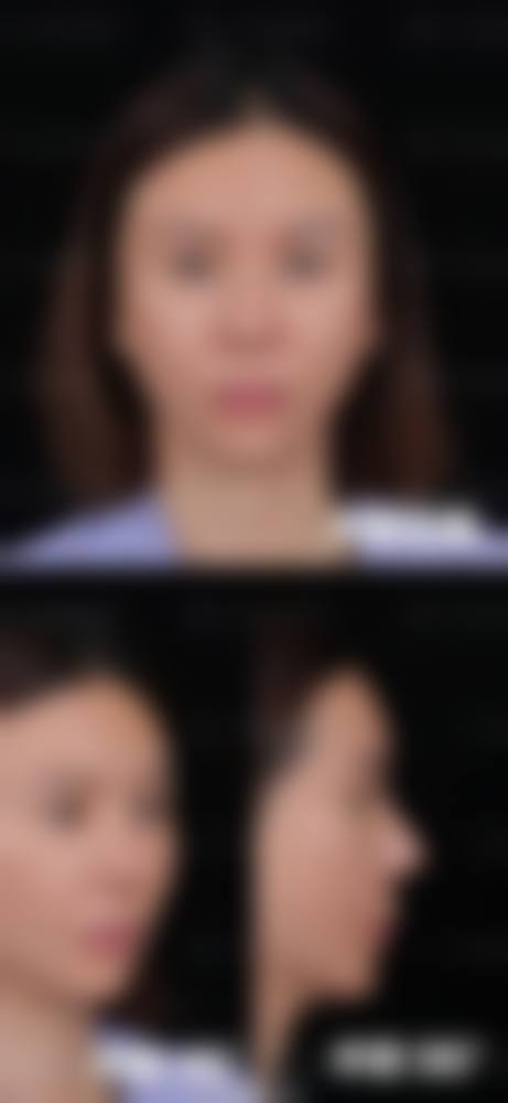 九、烟台伊然美整形医院真实的患者评价