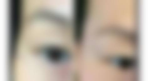 四、东莞轻颜丽美整形医院特色项目