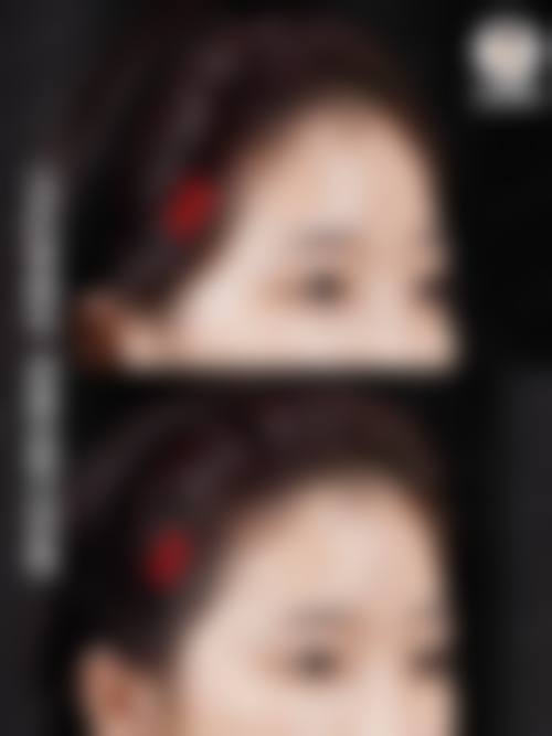 八、东莞轻颜丽美整形医院真实的患者评价