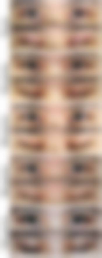 四、漳州科洛伊医疗美容门诊部特色项目