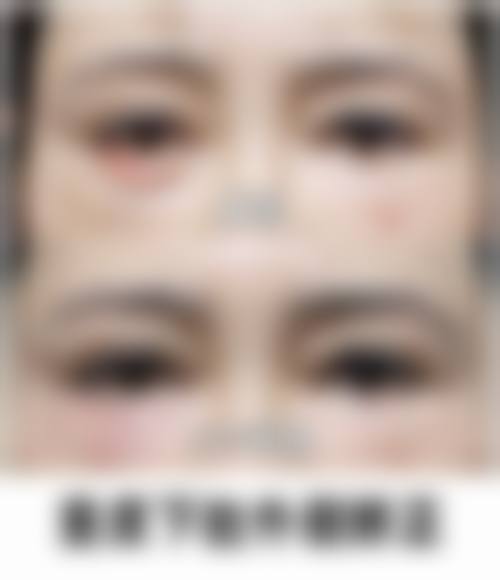 八、龙港孙松强整形医院真实的患者评价