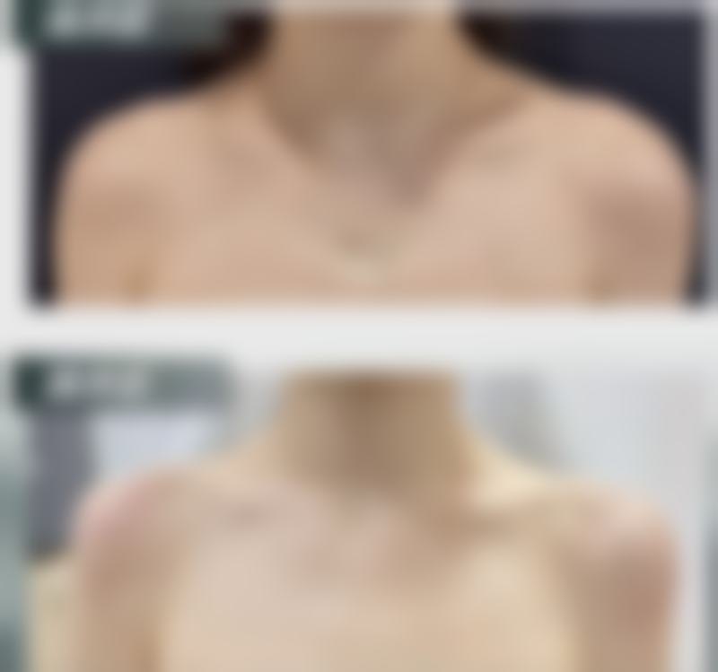 二、主流治疗方案对比