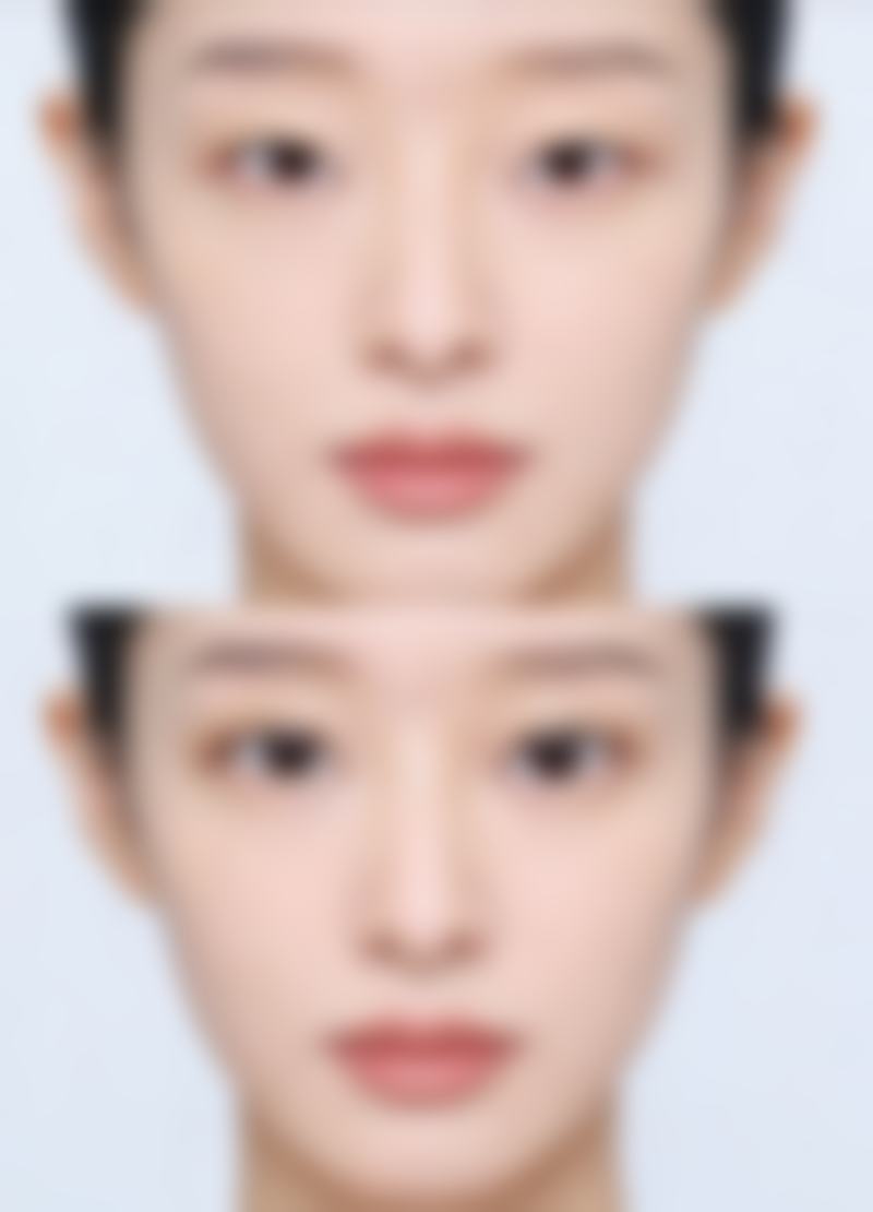 六、日常护理建议