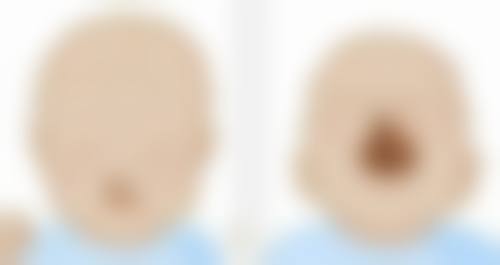 头发种植有用吗？了解其成活率高低，为你揭秘植发效果与持久度 