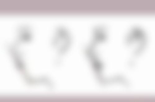 四、淋巴疤痕疙瘩的物理治疗