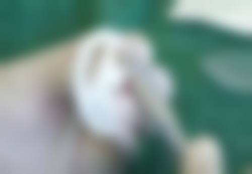 割包皮后能延长性生活时间吗？解密手术与性爱时长关联及影响因素 