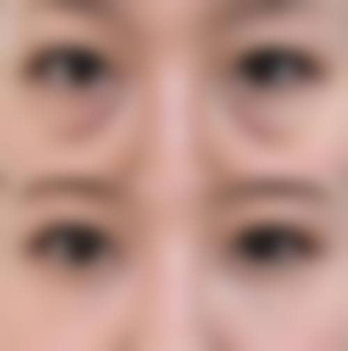 四、雅安河北医院整形美容科特色项目