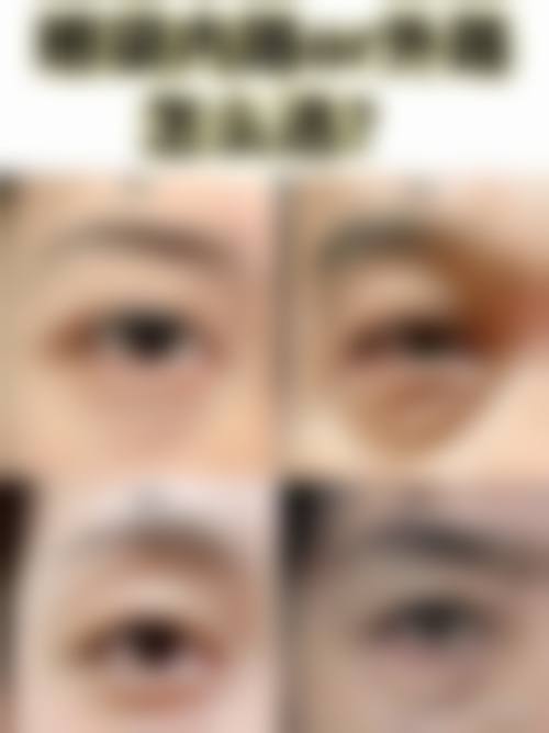 三、雅安河北医院整形美容科诊疗项目有哪些？