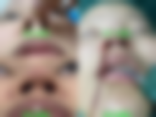 九、合肥悦恩整形医院真实的患者评价