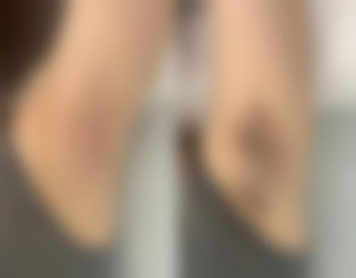 佛山宝之丽医疗美容门诊部真实的患者评价