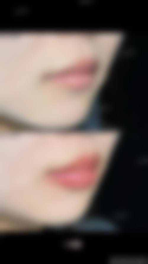 七、烟台小氧整形医院预约方式