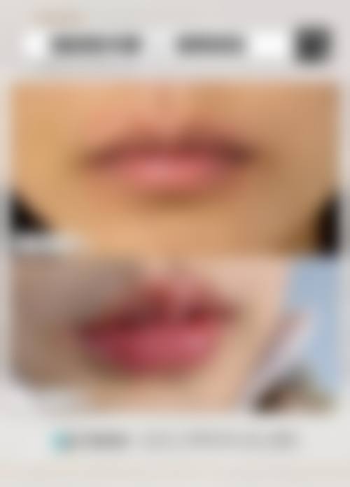 四、泰国三美泰整形医院特色项目