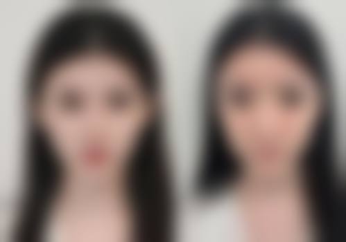 八、广州协佳医院腋臭科预约方式