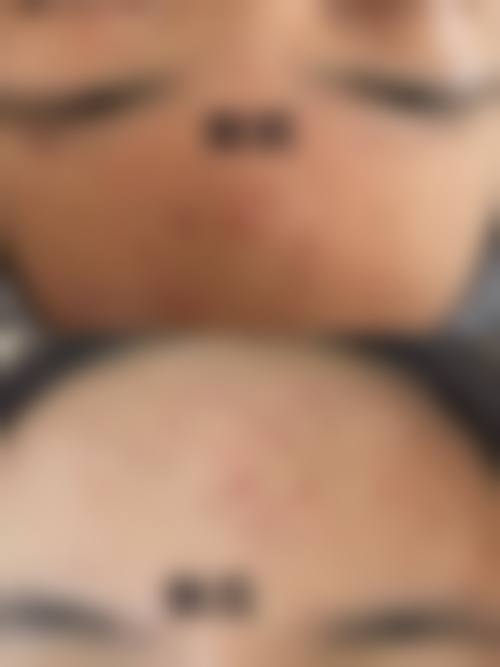 五、文山润美美莱医疗整形美容诊所价格表