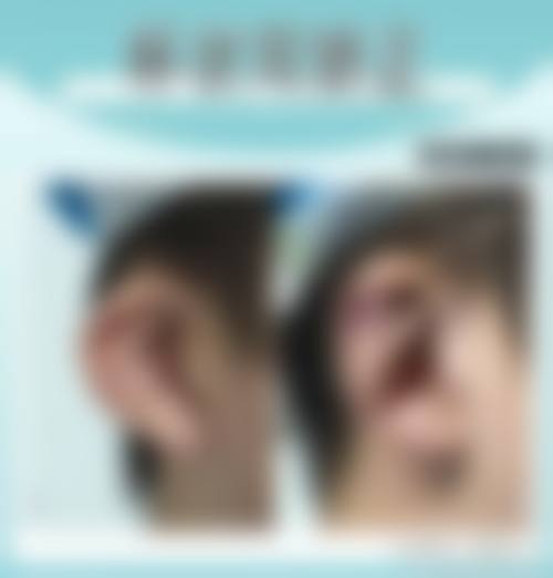 八、烟台小氧整形医院真实的患者评价