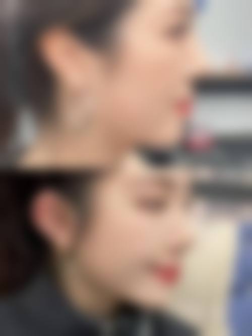 四、中山尼姬医疗美容门诊部特色项目