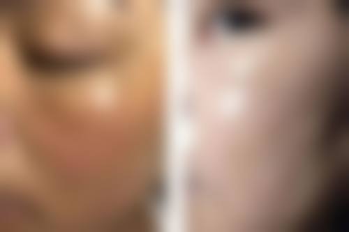 四、成都中研艺美医疗美容诊所特色项目