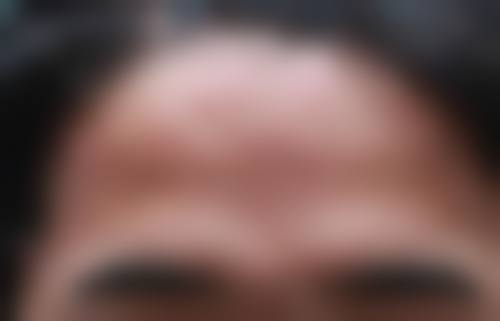 八、遵义颂氧轻奢整形医院真实的患者评价