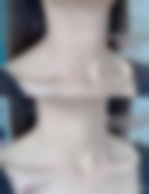 五、英德轻雅整形医院价格表