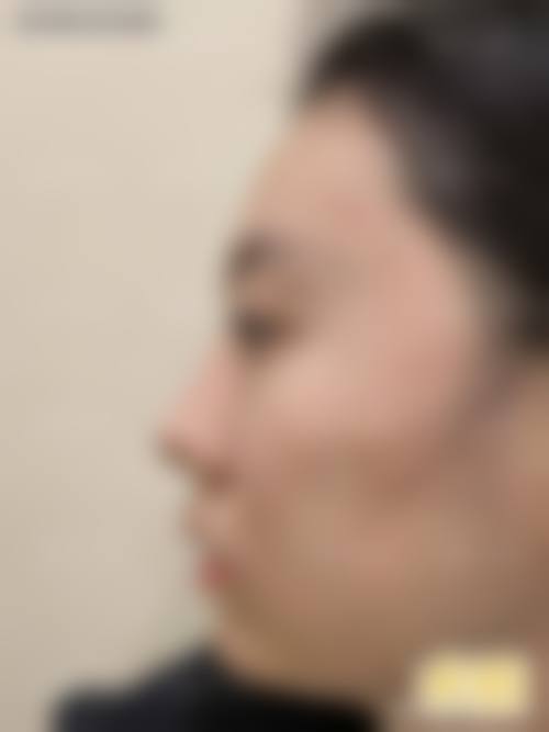 二、杭州美蜂医疗美容诊所怎么样?