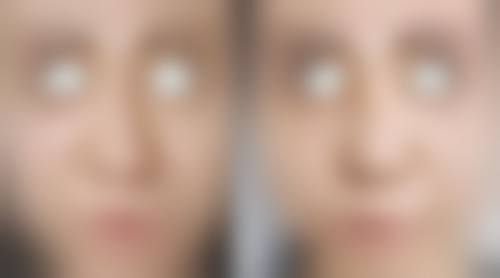 五、杭州美蜂医疗美容诊所价格表