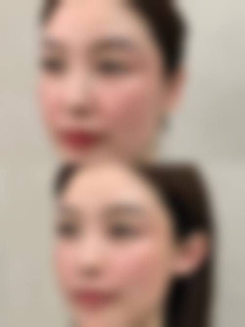 佛山宝之丽医疗美容门诊部正规吗?