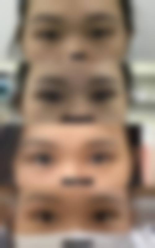 九、枣庄华美丽妍医疗美容诊所真实的患者评价