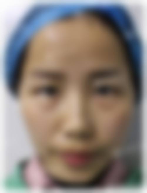 五、拜城县滤镜时刻整形医院价格表