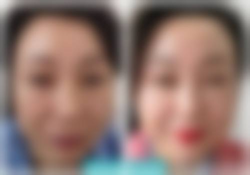 五、遵义颂氧轻奢整形医院价格表