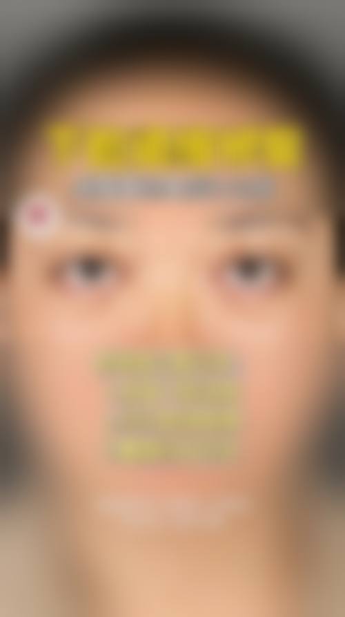 九、宁波芙艾整形医院真实的患者评价