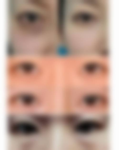 八、杭州美蜂医疗美容诊所真实的患者评价