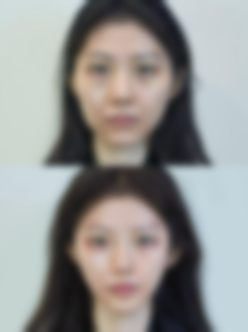 四、不同情况的针对性解决实例