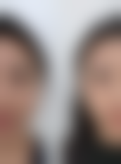 三、杭州美蜂医疗美容诊所诊疗项目有哪些?