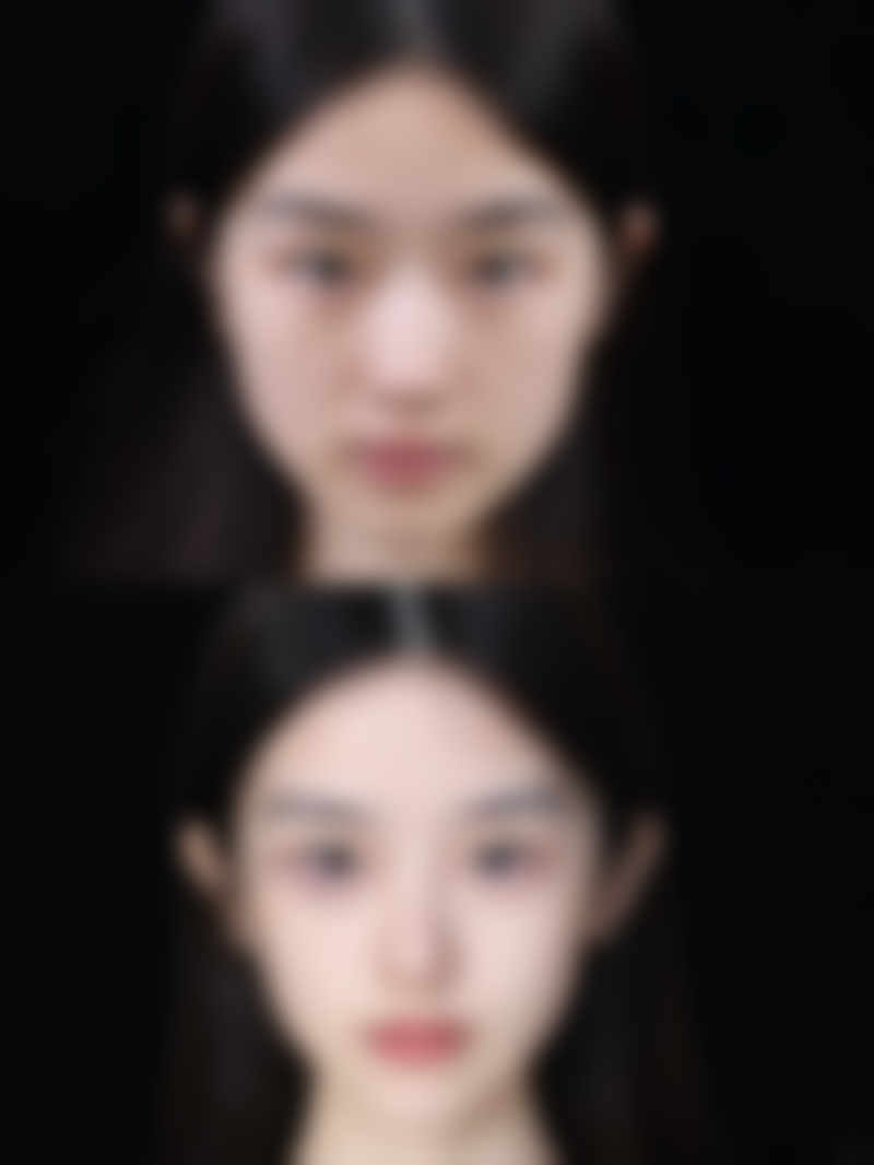 四、宁波芙艾整形医院特色项目