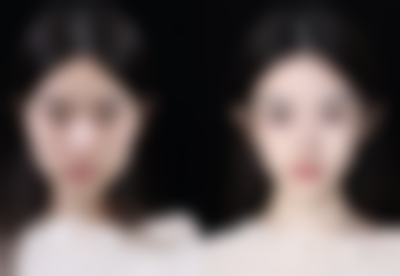 三、拜城县滤镜时刻整形医院诊疗项目有哪些？