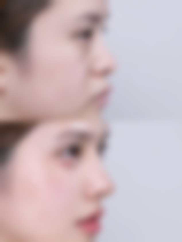 一、包皮环切术与敏感度的关系