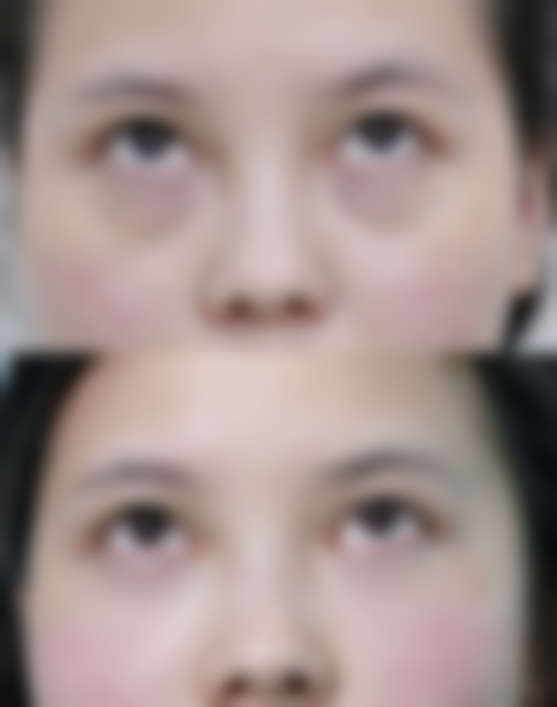 佛山宝之丽医疗美容门诊部怎么样?