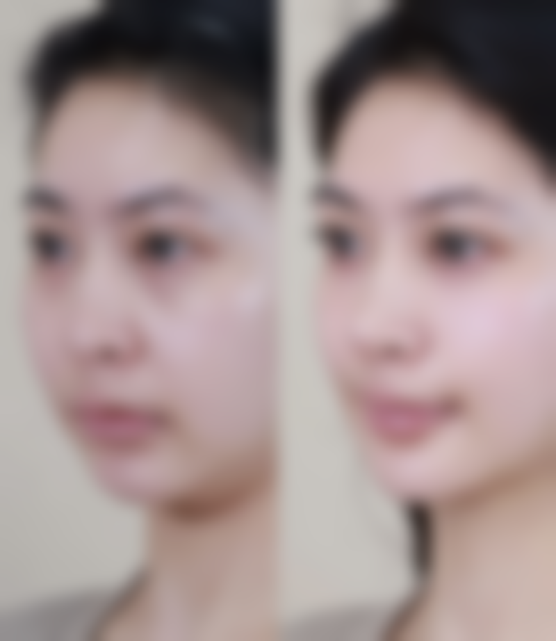 一、美容院除皱针常见成分