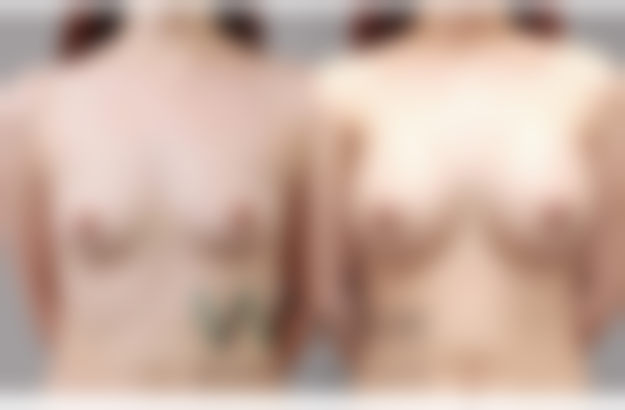 九、韩国原辰整形外科医院真实的患者评价