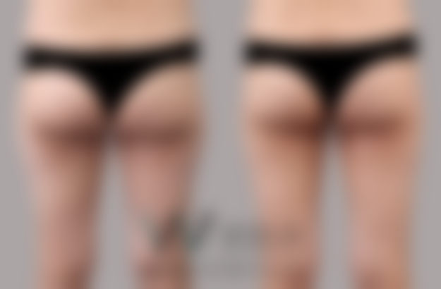 八、韩国原辰整形外科医院预约方式